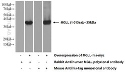 MGLL Rabbit anti-Human, Mouse, Rat, Polyclonal, Proteintech 20 &mu;L; Unconjugated:Anticuerpos