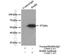 DARS Rabbit anti-Human, Mouse, Rat, Polyclonal, Proteintech 150 &mu;L;