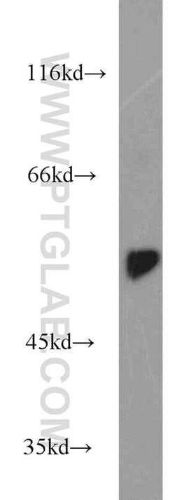 DARS Rabbit anti-Human, Mouse, Rat, Polyclonal, Proteintech 150 &mu;L;
