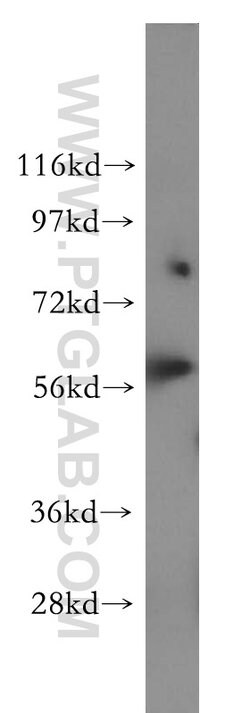 DARS Rabbit anti-Human, Mouse, Rat, Polyclonal, Proteintech 150 &mu;L;