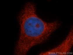 RPL14 Rabbit anti-Human, Mouse, Rat, Polyclonal, Proteintech:Antibodies:Primary