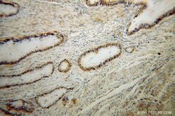 RPL14 Rabbit anti-Human, Mouse, Rat, Polyclonal, Proteintech:Antibodies:Primary