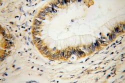 RPL14 Rabbit anti-Human, Mouse, Rat, Polyclonal, Proteintech:Antibodies:Primary