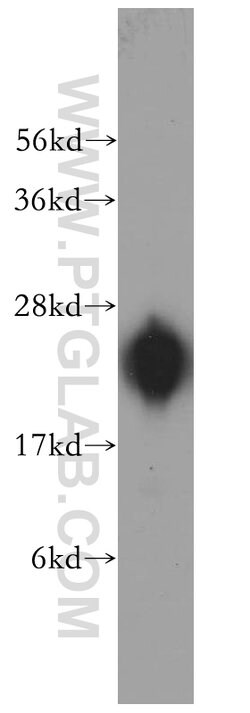 RPL14 Rabbit anti-Human, Mouse, Rat, Polyclonal, Proteintech:Antibodies:Primary