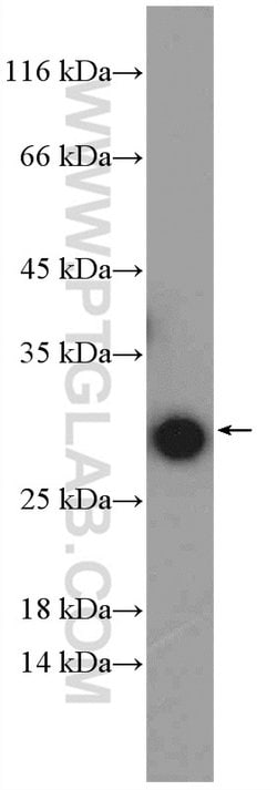 RPL14 Rabbit anti-Human, Mouse, Rat, Polyclonal, Proteintech:Antibodies:Primary