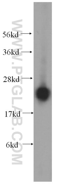 RPL14 Rabbit anti-Human, Mouse, Rat, Polyclonal, Proteintech:Antibodies:Primary