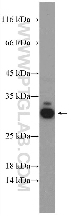 RPL14 Rabbit anti-Human, Mouse, Rat, Polyclonal, Proteintech:Antibodies:Primary