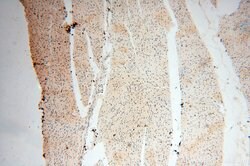 HIRIP3 Rabbit anti-Human, Mouse, Polyclonal, Proteintech 150 &mu;L | Buy Online | Proteintech | Fisher Scientific