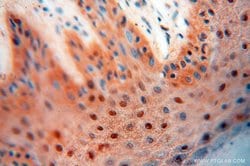 HIRIP3 Rabbit anti-Human, Mouse, Polyclonal, Proteintech 150 &mu;L | Buy Online | Proteintech | Fisher Scientific