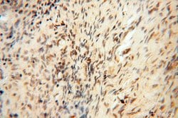 HIRIP3 Rabbit anti-Human, Mouse, Polyclonal, Proteintech 150 &mu;L | Buy Online | Proteintech | Fisher Scientific