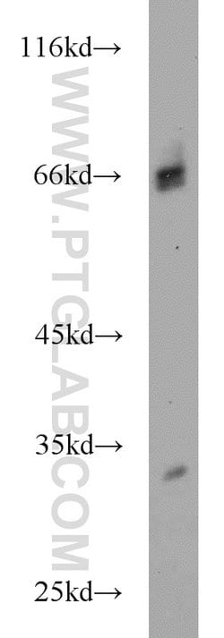 HIRIP3 Rabbit anti-Human, Mouse, Polyclonal, Proteintech 150 &mu;L | Buy Online | Proteintech | Fisher Scientific