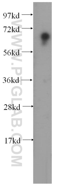 HIRIP3 Rabbit anti-Human, Mouse, Polyclonal, Proteintech 150 &mu;L | Buy Online | Proteintech | Fisher Scientific