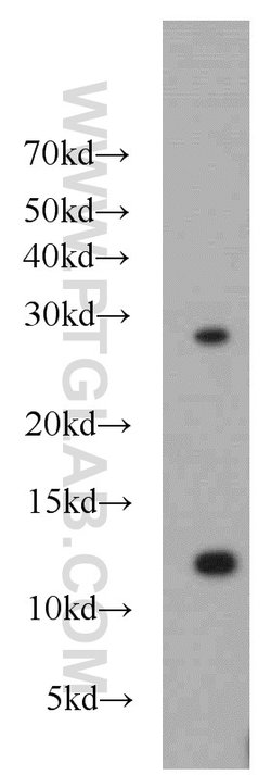 DDA1 Rabbit anti-Human, Mouse, Rat, Polyclonal, Proteintech 150 &mu;L;