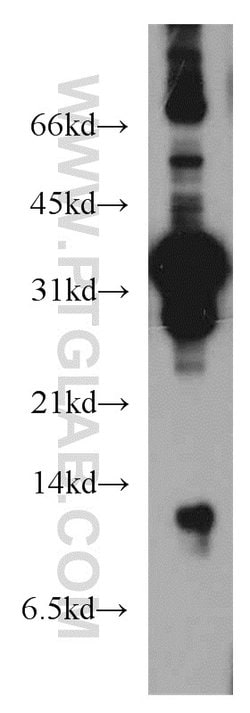 DDA1 Rabbit anti-Human, Mouse, Rat, Polyclonal, Proteintech 150 &mu;L;