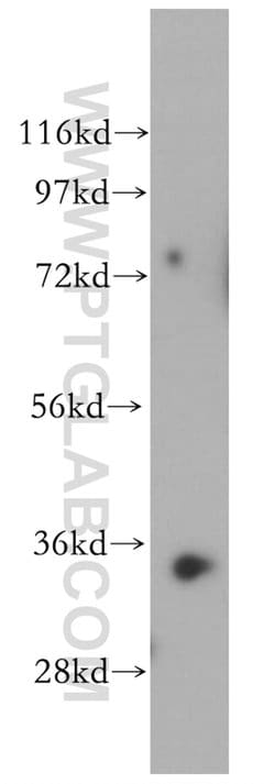 RENALASE Rabbit anti-Human, Mouse, Rat, Polyclonal, Proteintech:Antikörper:Primärantikörper