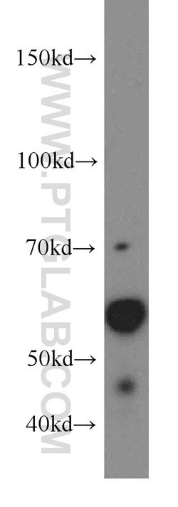 ARIH2 Rabbit anti-Human, Mouse, Rat, Polyclonal, Proteintech:Antibodies:Primary