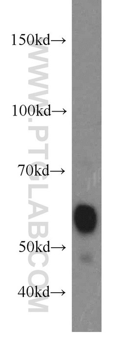 ARIH2 Rabbit anti-Human, Mouse, Rat, Polyclonal, Proteintech:Antibodies:Primary
