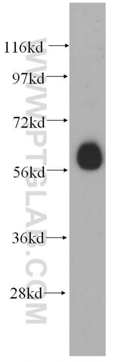 ARIH2 Rabbit anti-Human, Mouse, Rat, Polyclonal, Proteintech:Antibodies:Primary