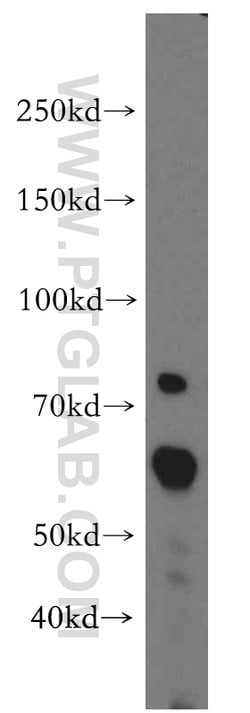 ARIH2 Rabbit anti-Human, Mouse, Rat, Polyclonal, Proteintech:Antibodies:Primary