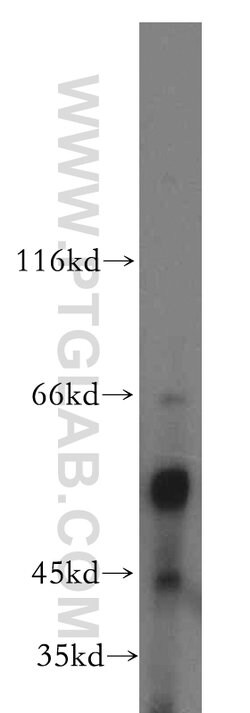 ARIH2 Rabbit anti-Human, Mouse, Rat, Polyclonal, Proteintech:Antibodies:Primary