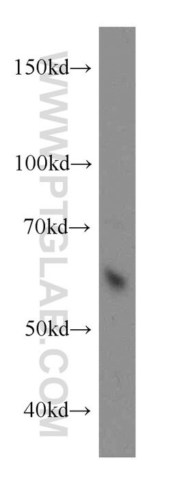 ARIH2 Rabbit anti-Human, Mouse, Rat, Polyclonal, Proteintech:Antibodies:Primary