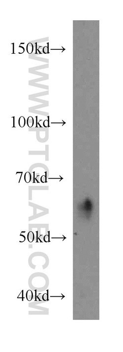 ARIH2 Rabbit anti-Human, Mouse, Rat, Polyclonal, Proteintech:Antibodies:Primary