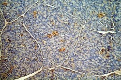 ENC1 Rabbit anti-Human, Mouse, Rat, Polyclonal, Proteintech 150 &mu;L;