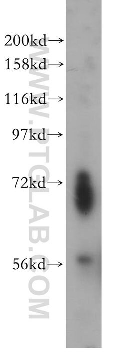 ENC1 Rabbit anti-Human, Mouse, Rat, Polyclonal, Proteintech 150 &mu;L;
