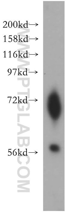 ENC1 Rabbit anti-Human, Mouse, Rat, Polyclonal, Proteintech 150 &mu;L;