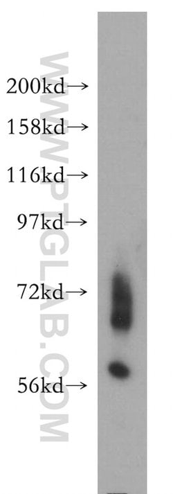 ENC1 Rabbit anti-Human, Mouse, Rat, Polyclonal, Proteintech 150 &mu;L;