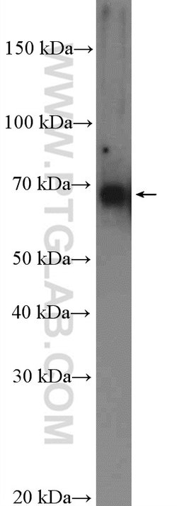 ENC1 Rabbit anti-Human, Mouse, Rat, Polyclonal, Proteintech 150 &mu;L;