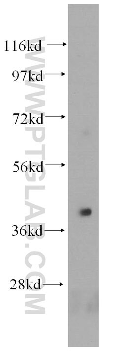 HLA-E Rabbit anti-Human, Polyclonal, Proteintech:Antibodies:Primary Antibodies