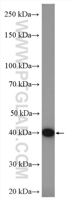 HLA-E Rabbit anti-Human, Polyclonal, Proteintech:Antibodies:Primary Antibodies