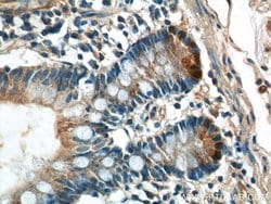 Lysozyme Rabbit anti-Human, Mouse, Rat, Polyclonal, Proteintech 150 &mu;L;