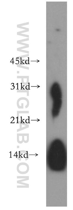 Lysozyme Rabbit anti-Human, Mouse, Rat, Polyclonal, Proteintech 150 &mu;L;