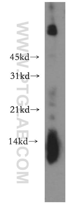 Lysozyme Rabbit anti-Human, Mouse, Rat, Polyclonal, Proteintech 150 &mu;L;