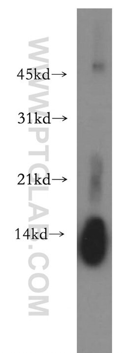 Lysozyme Rabbit anti-Human, Mouse, Rat, Polyclonal, Proteintech 150 &mu;L;