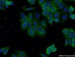 Thumbnail_DNPEP Rabbit anti-Human, Polyclonal, Proteintech 150 &mu;L; Unconjugated:Antibodies