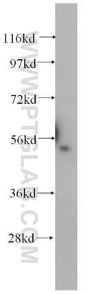 Thumbnail_DNPEP Rabbit anti-Human, Polyclonal, Proteintech 150 &mu;L; Unconjugated:Antibodies