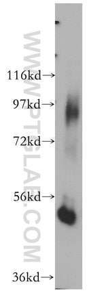 Thumbnail_DNPEP Rabbit anti-Human, Polyclonal, Proteintech 150 &mu;L; Unconjugated:Antibodies