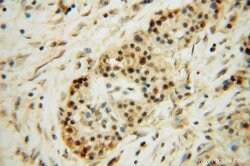 OSGEP Rabbit anti-Human, Mouse, Rat, Polyclonal, Proteintech 150 &mu;L;