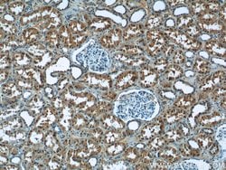 OSGEP Rabbit anti-Human, Mouse, Rat, Polyclonal, Proteintech 150 &mu;L;