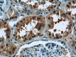 OSGEP Rabbit anti-Human, Mouse, Rat, Polyclonal, Proteintech 150 &mu;L;