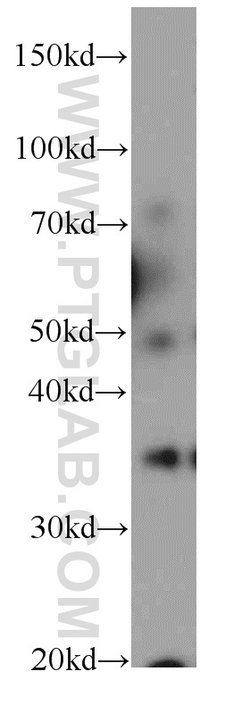 OSGEP Rabbit anti-Human, Mouse, Rat, Polyclonal, Proteintech 150 &mu;L;