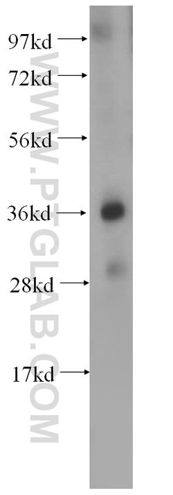 OSGEP Rabbit anti-Human, Mouse, Rat, Polyclonal, Proteintech 150 &mu;L;