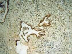 RING1 Rabbit anti-Human, Mouse, Rat, Polyclonal, Proteintech:Antibodies:Primary
