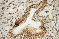 RING1 Rabbit anti-Human, Mouse, Rat, Polyclonal, Proteintech:Antibodies:Primary