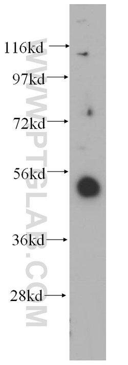 RING1 Rabbit anti-Human, Mouse, Rat, Polyclonal, Proteintech:Antibodies:Primary