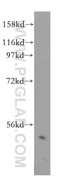 RING1 Rabbit anti-Human, Mouse, Rat, Polyclonal, Proteintech:Antibodies:Primary