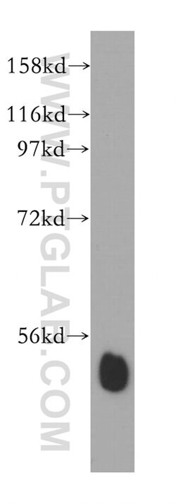 RING1 Rabbit anti-Human, Mouse, Rat, Polyclonal, Proteintech:Antibodies:Primary